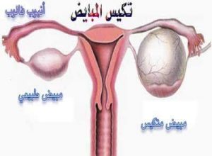 مين عندها تكيس مبايض وحملت الله يرزقها الي ترد علي عاجل وليس اجل يارب